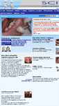 Mobile Screenshot of implant-scit.com